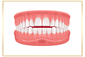 hình ảnh răng cắn hở