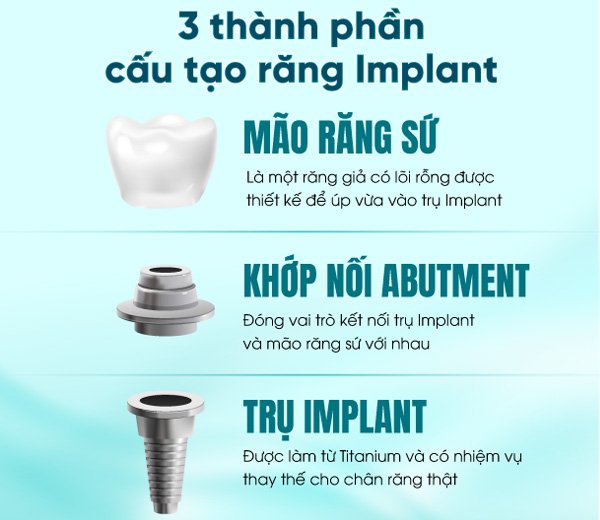 3 thành phần cấu tạo răng implant